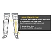 Easton Black Magic Legguards, Youth 12,5"